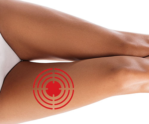Treatment Pain in the thigh mobile